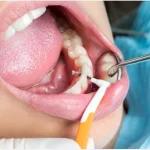 Healthy Smile