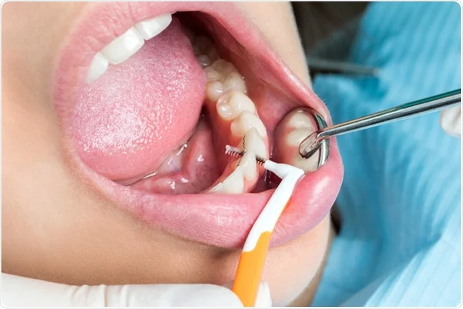How Saliva Testing Can Predict Your Future Dental Health Risks